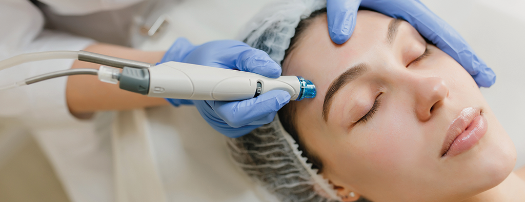 Dermapen Per Microneedling - Medicina Estetica A Bergamo